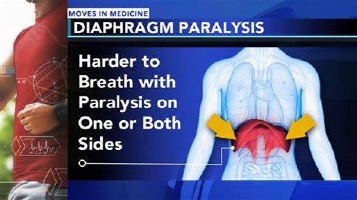 What happens in diaphragm paralysis?